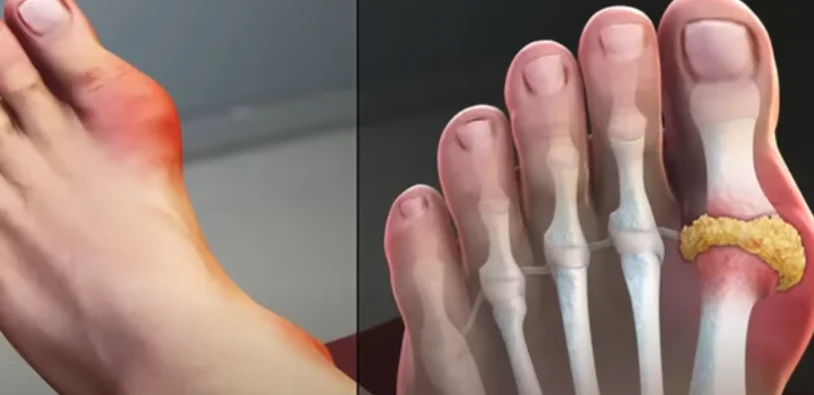 Baking soda foot soak