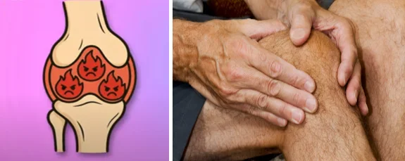 Joint stiffness relief