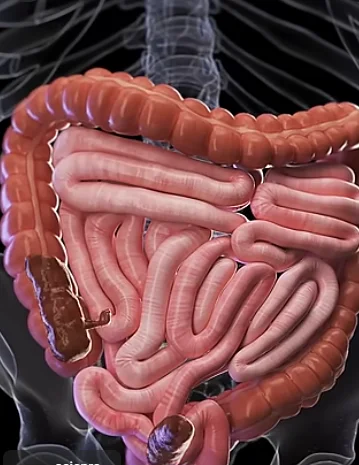 Benefits Of Human Deworming Image