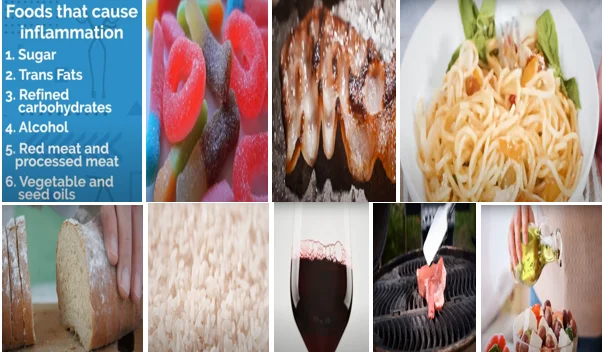 Foods that cause inflammation overview