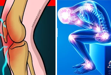 Joint discomfort dairy