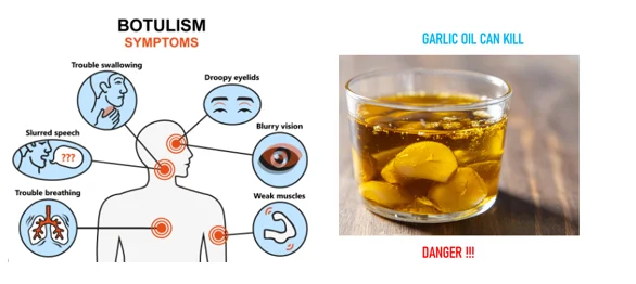 garlic in oil botulism risk for seniors - illustration 1