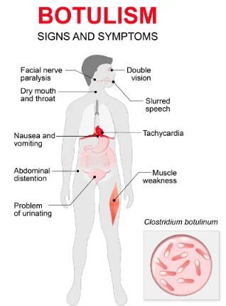 garlic in oil botulism risk for seniors - illustration 13