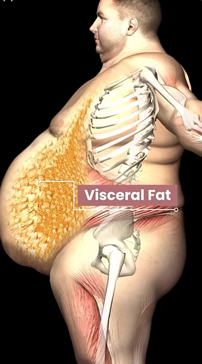 Belly fat health risks