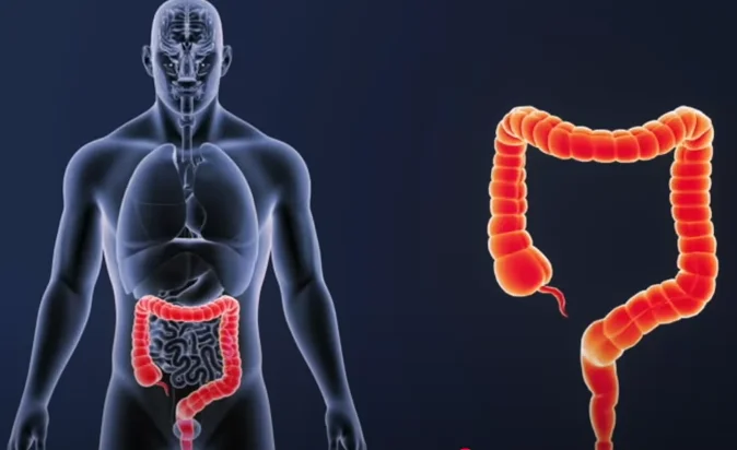 how to fix gut health - illustration 7
