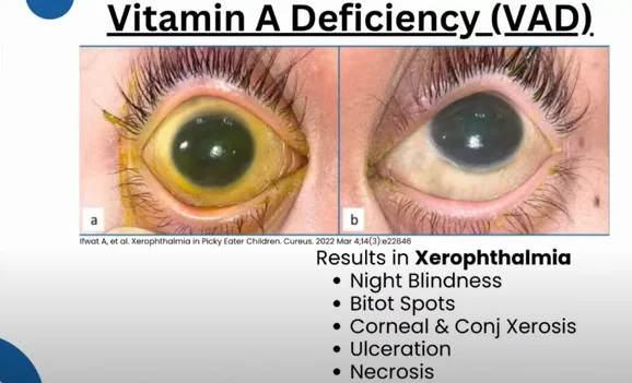 important nutrients for eye health - illustration 5