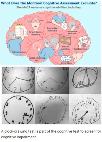 Doctor visit cognitive evaluation illustration