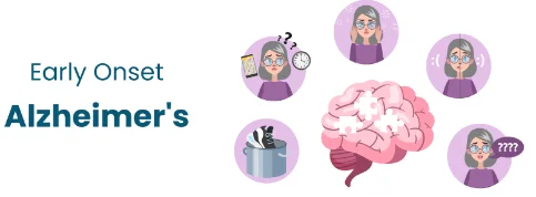 Misplacing items illustration