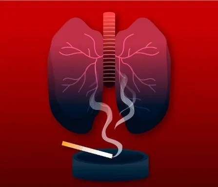 Respiratory infection causing mucus production