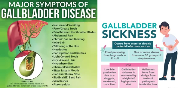 Gallbladder warning signs illustration