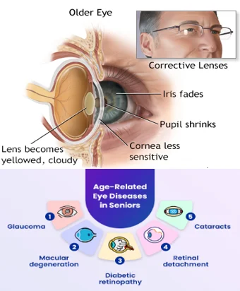 Eye changes after 40
