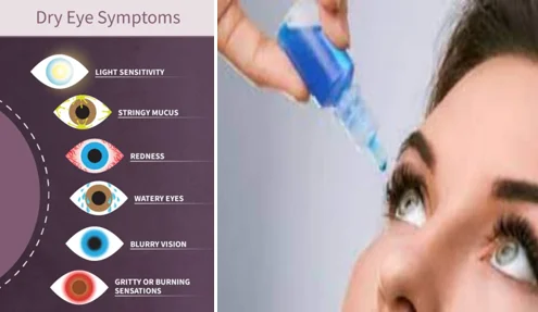 Hydration dry eyes