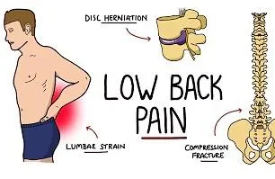 Advanced prostate cancer symptoms including back pain and fatigue