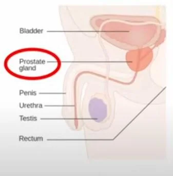 Understanding prostate cancer signs and symptoms for better health outcomes