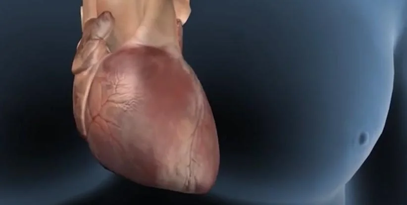 Cardiovascular complications of hyperthyroidism including atrial fibrillation risk