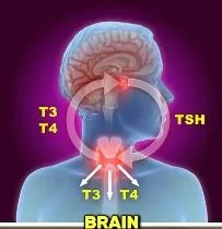 Insomnia and neurological symptoms associated with overactive thyroid