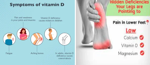 Vitamin D for leg strength seniors
