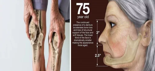when bones become weak in seniors - illustration 11
