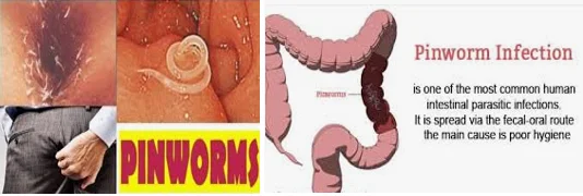 unexplained fatigue in older adults parasites - illustration 7